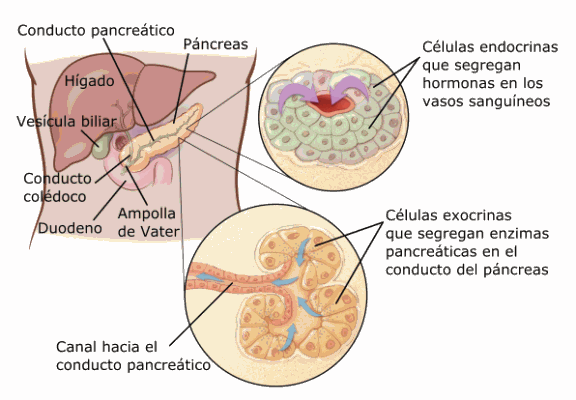 Cáncer de Páncreas