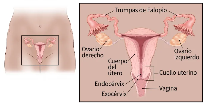 Cáncer de cuello uterino